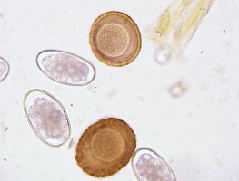 strongyle and ascarid eggs